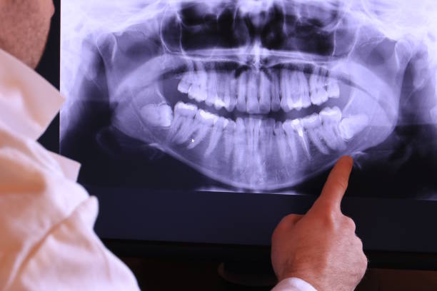 Best Broken or Chipped Tooth Repair in Titusville, FL